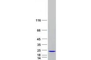 Western Blotting (WB) image for N(alpha)-Acetyltransferase 50, NatE Catalytic Subunit (NAA50) protein (Myc-DYKDDDDK Tag) (ABIN2725229)