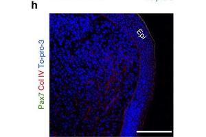 Immunofluorescence (Paraffin-embedded Sections) (IF (p)) image for anti-Collagen, Type IV (COL4) antibody (ABIN5596835)