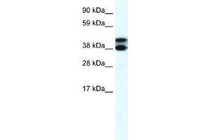 Human Lung; WB Suggested Anti-RFP2 Antibody Titration: 0. (TRIM13 抗体  (Middle Region))