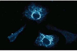 Immunofluorescence staining of HeLa cells (Human cervical epitheloid carcinoma, ATCC CCL-2.