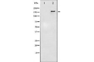 Western blot analysis of HER4 phosphorylation expression in EGF treated HuvEc whole cell lysates,The lane on the left is treated with the antigen-specific peptide. (ERBB4 抗体  (pTyr1284))