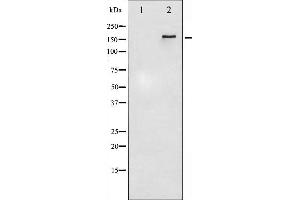 Western blot analysis of HER4 phosphorylation expression in EGF treated HuvEc whole cell lysates,The lane on the left is treated with the antigen-specific peptide. (ERBB4 抗体  (pTyr1284))