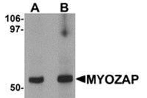 Western blot analysis of MYOZAP in rat kidney tissue lysate with MYOZAP antibody at (A) 1 and (B) 2 μg/ml. (MYZAP 抗体  (C-Term))
