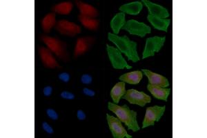 ABIN6264094 and ABIN6279286 staining Hela cells(30 min of UV treatment) by IF/ICC.