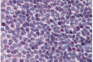 Human Spleen: Formalin-Fixed, Paraffin-Embedded (FFPE) (PCBP1 抗体  (AA 208-257))
