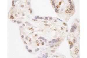 anti-Wolf-Hirschhorn Syndrome Candidate 2 (WHSC2) (AA 499-549) antibody