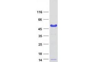 Western Blotting (WB) image for BRCA2 and CDKN1A Interacting Protein (BCCIP) (Transcript Variant B) protein (Myc-DYKDDDDK Tag) (ABIN2715186)