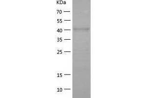 ATG4A Protein (AA 1-398) (His tag)