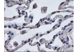 Immunohistochemistry (IHC) image for anti-Mitogen-Activated Protein Kinase 6 (MAPK6) (AA 345-721) antibody (ABIN2725419)