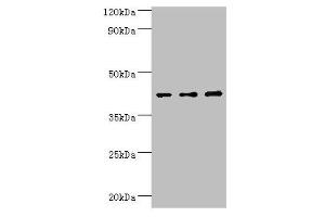 Western blot All lanes: Leukocyte elastase inhibitor antibody at 4 μg/mL Lane 1: MCF-7 whole cell lysate Lane 2: Hela whole cell lysate Lane 3: HepG2 whole cell lysate Secondary Goat polyclonal to rabbit IgG at 1/10000 dilution Predicted band size: 43, 27 kDa Observed band size: 43 kDa (SERPINB1 抗体  (AA 100-379))
