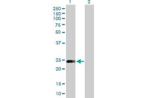 Western Blot analysis of STX8 expression in transfected 293T cell line by STX8 MaxPab polyclonal antibody. (STX8 抗体  (AA 1-236))