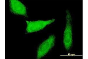 Immunofluorescence of purified MaxPab antibody to PEG10 on HeLa cell. (PEG10 抗体  (AA 1-325))