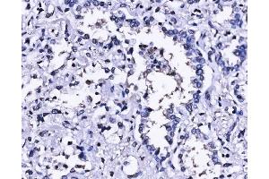 IHC analysis of SUN2 using anti-SUN2 antibody (ABIN7601278).