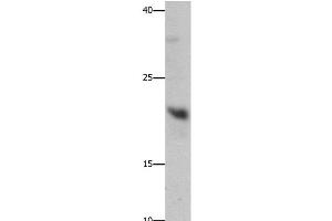 Western Blot analysis of Mouse liver tissue using GFER Polyclonal Antibody at dilution of 1:750 (GFER 抗体)