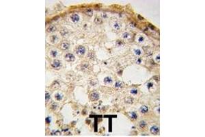 Formalin-fixed and paraffin-embedded human testis tissue reacted with DDX4 antibody (C-term) (ABIN388152 and ABIN2846906) , which was peroxidase-conjugated to the secondary antibody, followed by DAB staining. (DDX4 抗体  (C-Term))