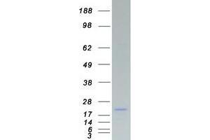 Western Blotting (WB) image for Synovial Sarcoma, X Breakpoint 2 (SSX2) (Transcript Variant 2) protein (Myc-DYKDDDDK Tag) (ABIN2732727)