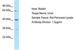 Image no. 1 for anti-Uroporphyrinogen Decarboxylase (UROD) (AA 51-100) antibody (ABIN6749872) (UROD 抗体  (AA 51-100))