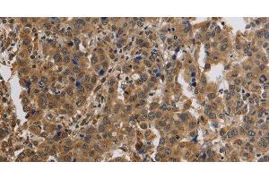 Immunohistochemistry (Paraffin-embedded Sections) (IHC (p)) image for anti-Potassium Large Conductance Calcium-Activated Channel, Subfamily M, beta Member 4 (KCNMB4) antibody (ABIN7239140)