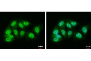 ICC/IF Image DDB1 antibody [N1N3] detects DDB1 protein at nucleus and cytoplasm by immunofluorescent analysis. (DDB1 抗体)