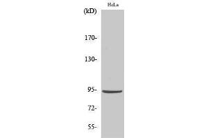 Western Blotting (WB) image for anti-Catenin, beta (CATNB) (Ser29) antibody (ABIN3174194) (beta Catenin 抗体  (Ser29))