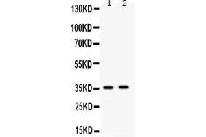 Western blot analysis of Apolipoprotein E expression in mouse spleen extract ( Lane 1) and mouse kidney extract ( Lane 2). (APOE 抗体  (AA 55-294))