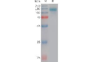 Human L2 Protein, His Tag on SDS-PAGE under reducing condition.