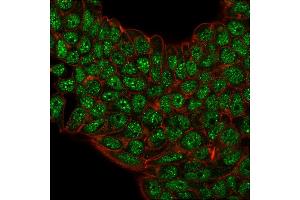 Immunofluorescence (IF) image for anti-Small Ubiquitin Related Modifier 2 (SUMO2) antibody (ABIN6940601)