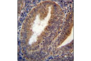 Immunohistochemistry analysis in Formalin Fixed and Paraffin Embedded Human uterus tissue using RRAGC Antibody (Center) followed by peroxidase conjugation of the secondary antibody and DAB staining. (GTR2 抗体  (Middle Region))