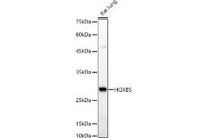 Western blot analysis of extracts of Rat lung, using HOXB5 antibody (ABIN7267769) at 1:510 dilution. (HOXB5 抗体  (AA 1-170))