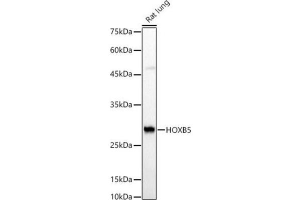 HOXB5 抗体  (AA 1-170)