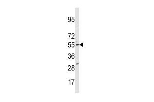 Western Blotting (WB) image for anti-Cytochrome P450, Family 11, Subfamily A, Polypeptide 1 (CYP11A1) (AA 88-120), (N-Term) antibody (ABIN392388)