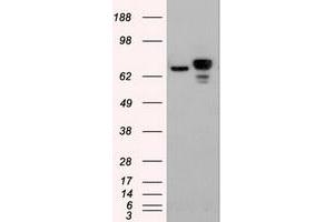 HEK293T cells were transfected with the pCMV6-ENTRY control (Left lane) or pCMV6-ENTRY CTNNB1 (RC208947) (Right lane) cDNA for 48 hrs and lysed. (CTNNB1 抗体  (AA 531-781))