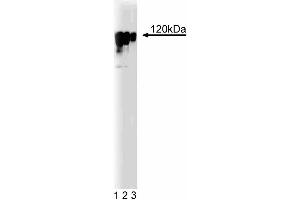 Western blot analysis of Eg5 on a human endothelial cell lysate. (KIF11 抗体  (AA 324-532))