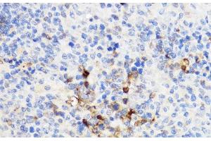 Immunohistochemistry of paraffin-embedded Rat spleen using YKL-40 / CHI3L1 Polyclonal Antibody at dilution of 1:100 (40x lens). (CHI3L1 抗体)