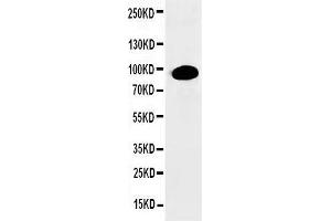 Anti-PKC alpha antibody, Western blotting WB: HELA Cell Lysate (PKC alpha 抗体  (N-Term))