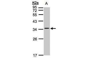WB Image Sample(30 ug whole cell lysate) A:Hep G2 , 12% SDS PAGE antibody diluted at 1:1000 (CACNG5 抗体  (Center))