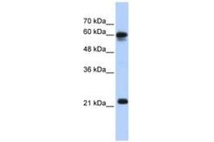 Image no. 1 for anti-Sema Domain, Immunoglobulin Domain (Ig), Transmembrane Domain (TM) and Short Cytoplasmic Domain, (Semaphorin) 4F (SEMA4F) (AA 91-140) antibody (ABIN6743418)