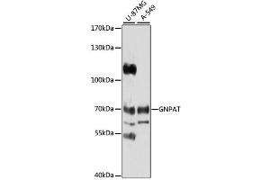 Western blot analysis of extracts of various cell lines, using GNPAT antibody (ABIN1872854) at 1:1000 dilution. (GNPAT 抗体)