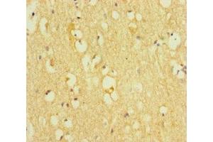 Immunohistochemistry of paraffin-embedded human brain tissue using ABIN7172313 at dilution of 1:100 (TOX3 抗体  (AA 8-305))