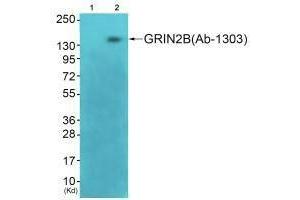 Western blot analysis of extracts from 3T3 cells (Lane 2), using GRIN2B (Ab-1303) antiobdy. (GRIN2B 抗体  (Ser1303))