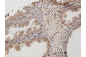 Immunoperoxidase of purified MaxPab antibody to CD44 on formalin-fixed paraffin-embedded human endometrium. (CD44 抗体  (AA 1-361))