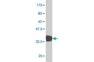 Western Blot detection against Immunogen (36. (BARX1 抗体  (AA 1-100))