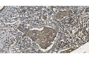 IHC analysis of MPI using anti-MPI antibody (ABIN7600514).