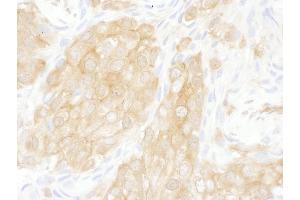 Immunohistochemistry (IHC) image for anti-14-3-3 theta (YWHAQ) (AA 100-150) antibody (ABIN7454480)