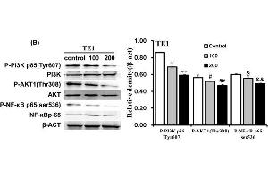 Qigesan inhibits PI3K/AKT and NF-κB signaling pathwayEca109 and TE1 cells were treated with QGS (0, 100, and 200 μg/mL) for 24 h. (AKT1 抗体  (pThr308))