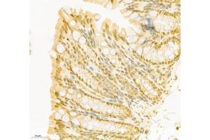 Immunohistochemistry (Paraffin-embedded Sections) (IHC (p)) image for anti-Poly A Binding Protein Nuclear 1 (PABPN1) antibody (ABIN7075116)