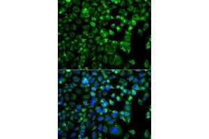 Immunofluorescence (IF) image for anti-Mitogen-Activated Protein Kinase Kinase Kinase MLT (ZAK) (AA 1-330) antibody (ABIN6150360)