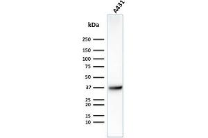 Western Blot Analysis of Human A431 cell lysate using GLUT-1 Mouse Monoclonal Antibody (GLUT1/2475). (GLUT1 抗体  (AA 203-305))