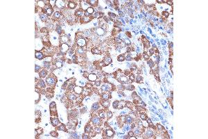 Immunohistochemistry of paraffin-embedded human liver using GOT2 Rabbit mAb (ABIN7267427) at dilution of 1:100 (40x lens). (GOT2 抗体)