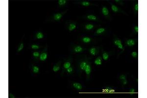 Immunofluorescence of monoclonal antibody to C1D on HeLa cell. (C1D 抗体  (AA 1-141))
